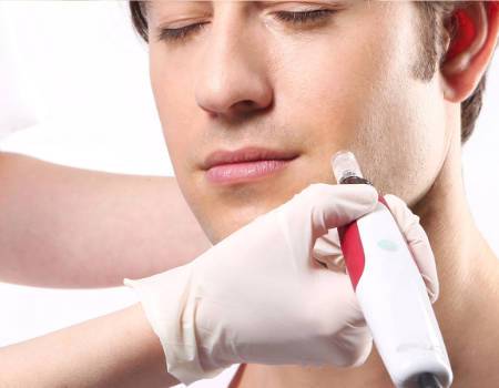 Microneedling at The K Spa