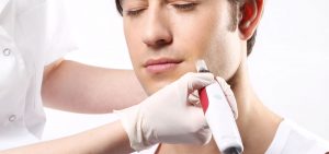 man during a Scar Treatment on his face