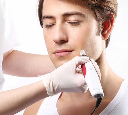 man during a Scar Treatment on his face