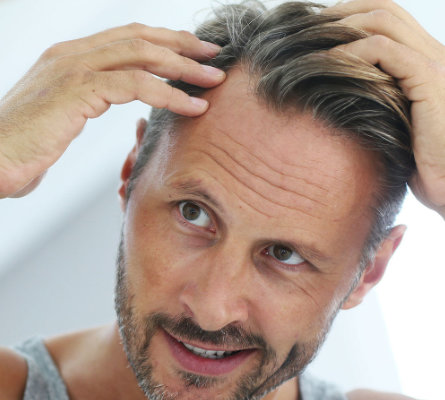 man checking his hair after a PRP Scalp Hair Growth Injection